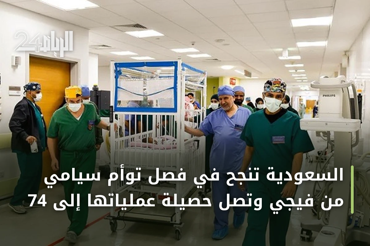 السعودية تنجح في فصل توأم سيامي من فيجي وتصل حصيلة عملياتها إلى 74