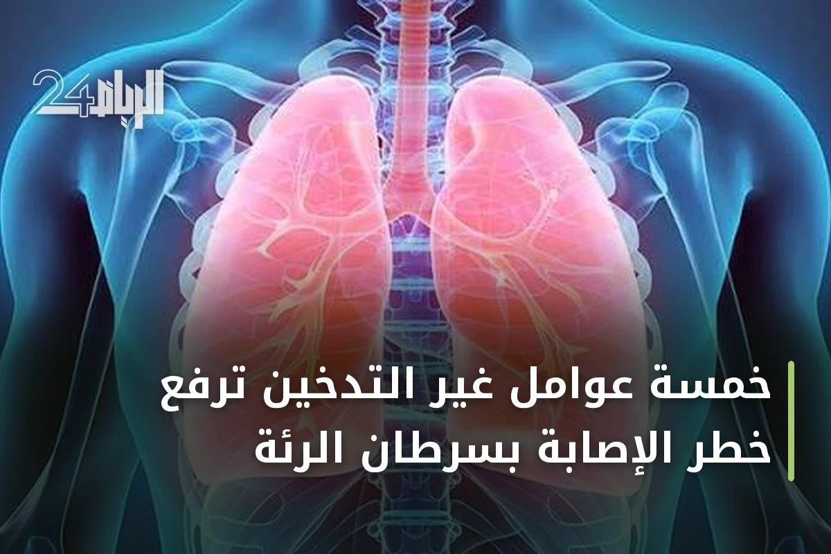 خمسة عوامل غير التدخين ترفع خطر الإصابة بسرطان الرئة