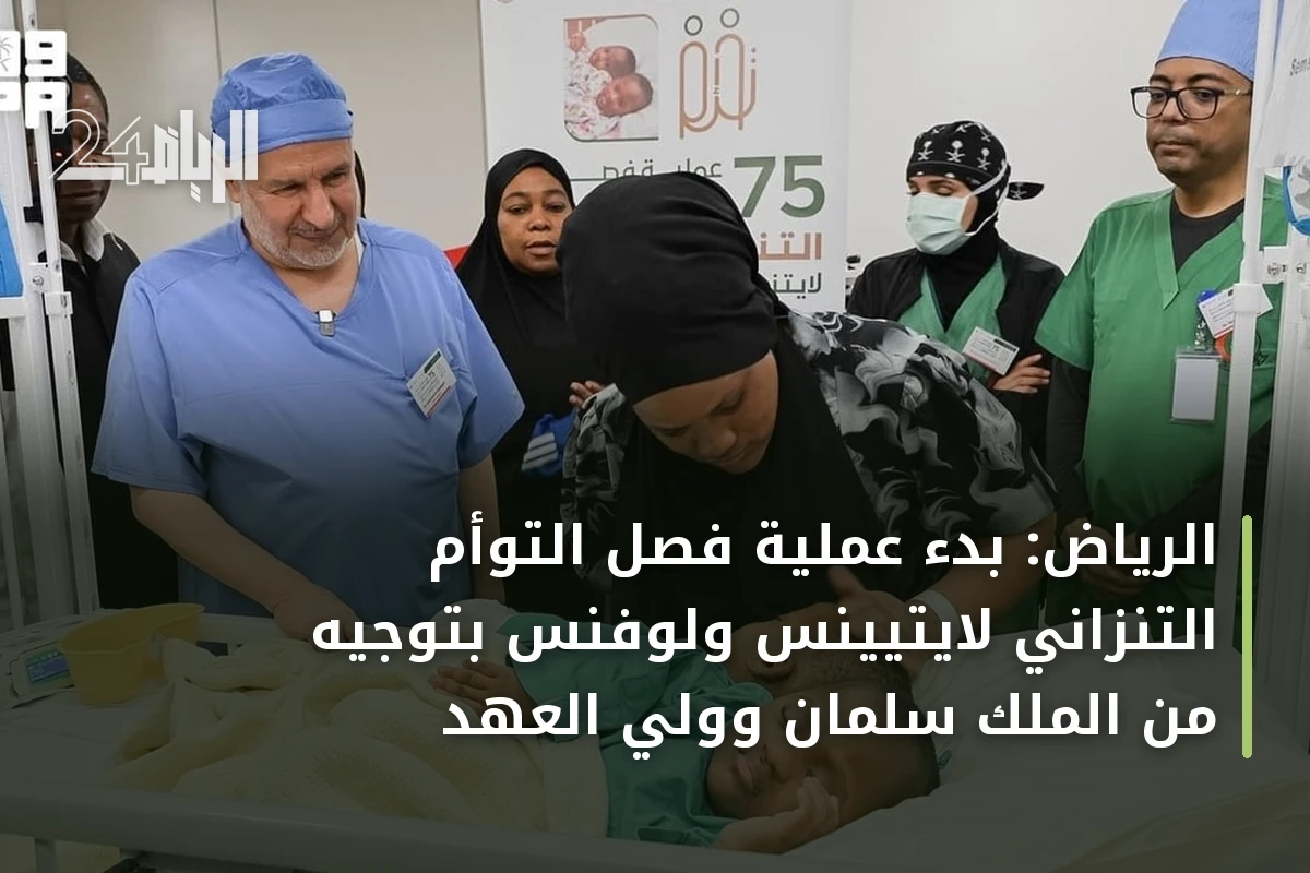 الرياض: بدء عملية فصل التوأم التنزاني لايتيينس ولوفنس بتوجيه من الملك سلمان وولي العهد