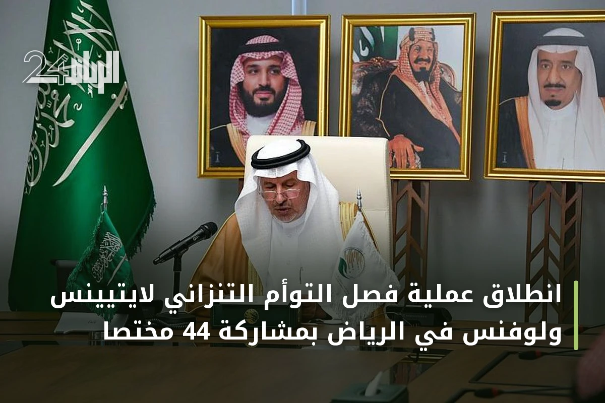 انطلاق عملية فصل التوأم التنزاني لايتيينس ولوفنس في الرياض بمشاركة 44 مختصاً