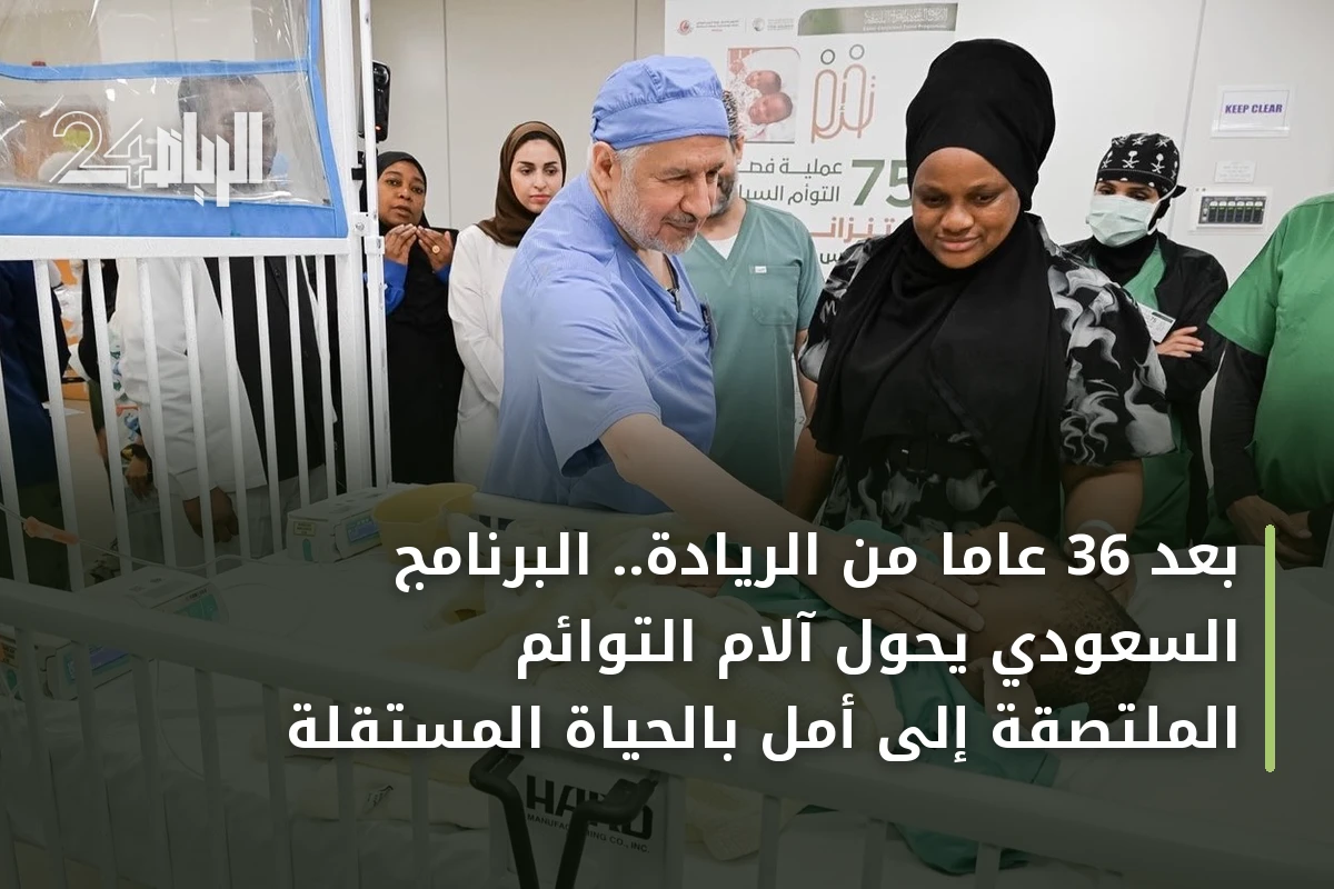 بعد 36 عاماً من الريادة.. البرنامج السعودي يحوّل آلام التوائم الملتصقة إلى أمل بالحياة المستقلة