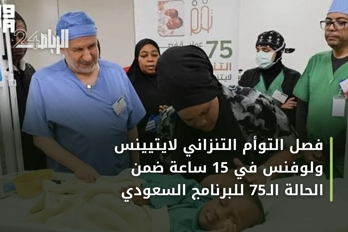 فصل التوأم التنزاني لايتيينس ولوفنس في 15 ساعة ضمن الحالة الـ75 للبرنامج السعودي